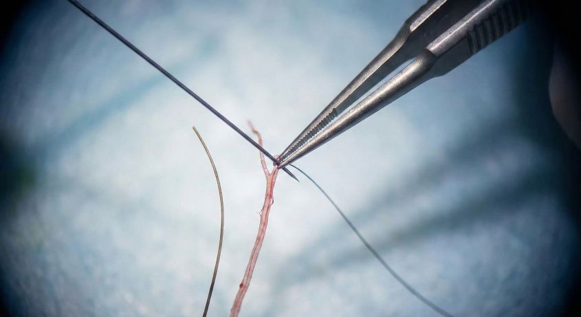 マイクロサージャリーの視界イメージ